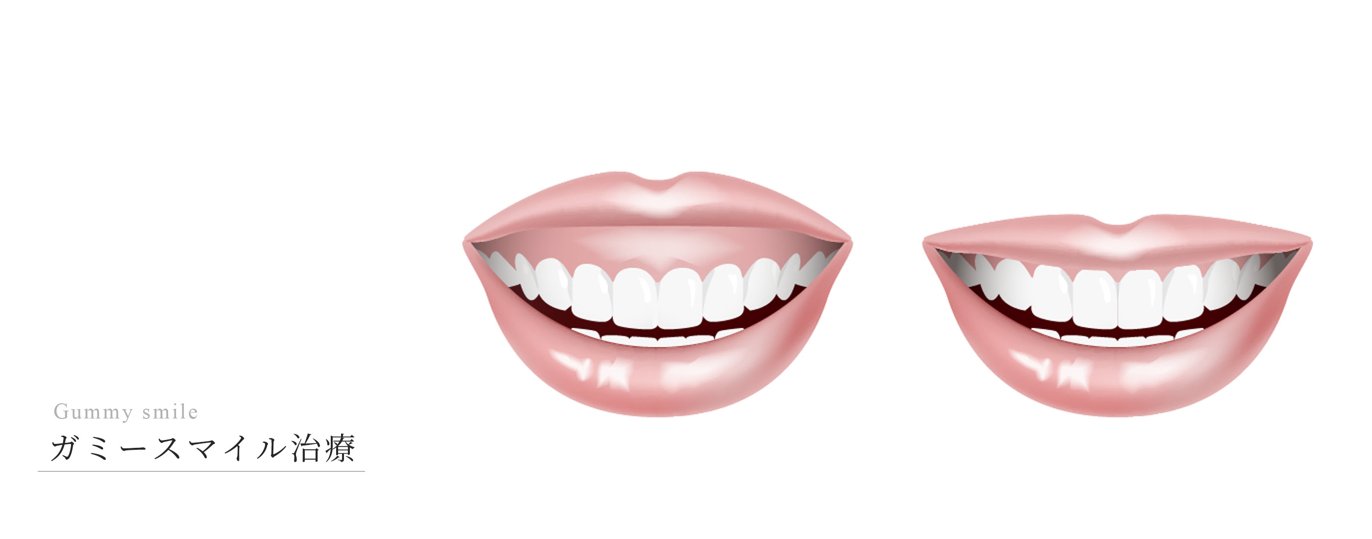 キービジュアル